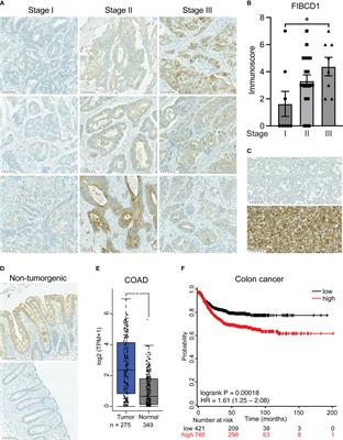 Expression of FIBCD1 by intestinal epithelial cells alleviates inflammation-driven tumorigenesis in a mouse model of colorectal cancer